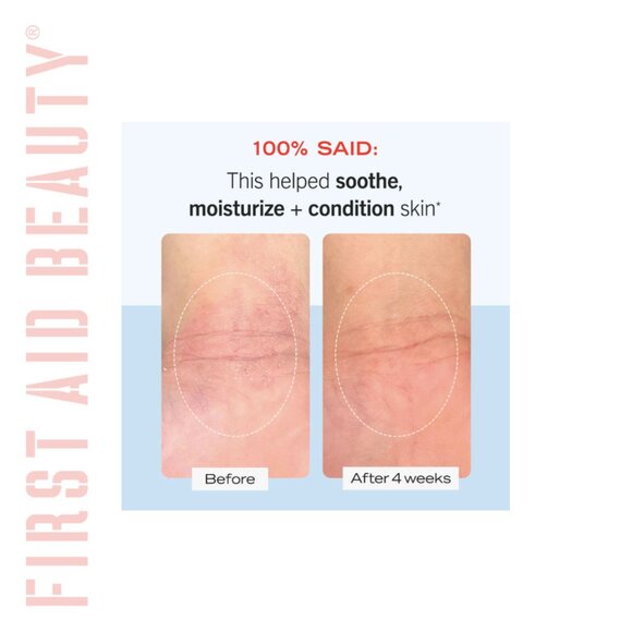 FIRST AID BEAUTY Flawlessly Fab Skin Ensemble - Picture 15 of 16